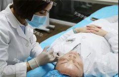天津伊美尔技术院长特色项目发布季：张氏针雕抗衰，风靡全球的细胞级抗衰新科技！